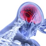 Neurological Lyme Disease Treatment – What You Need To Know
