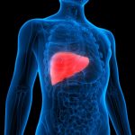 Lyme Detox Methods – Natural Support For Herxheimer Reactions